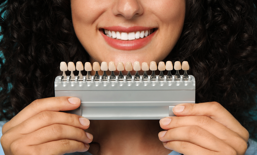 porcelain veneers cost Australia